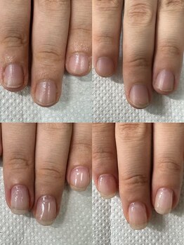 カンパニュラ(Campanula)/自爪育成初回ケア