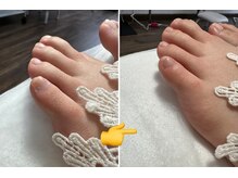 レタラ(Retar)/フットケア