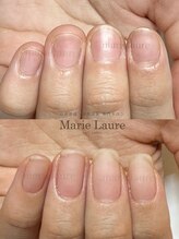 マリーロール 梅田店(Marie Laure)/自爪育成/深爪矯正/ネイルケア