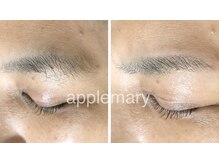 アップル マリー 江別/■糸脱毛（似合わせ眉毛脱毛）