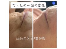 ルルエステ アンド 整体院(Lulu)の雰囲気（一回でどこまで変化する？体験必須|）