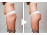 【下半身ラインすっきり】痩身マシンケア60分(背面1部位)