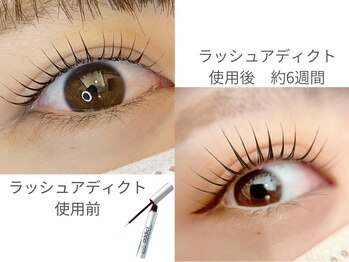 エラン(Elan)/ラッシュアディクトの実力♪