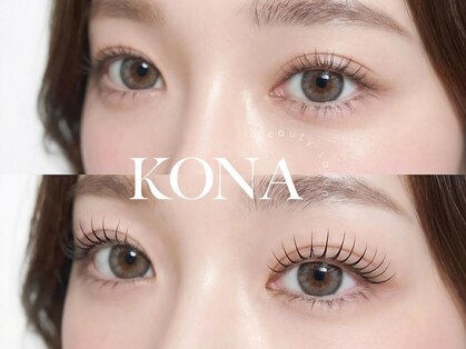 コナ(KONA)の写真