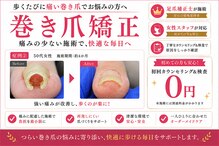 巻き爪矯正ラボ 水戸