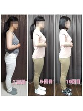 整体サロンアトレ/札幌でお腹・太もも体型悩みなら