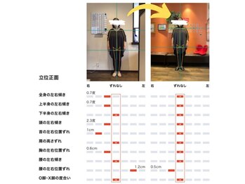 しのまる整体/<グループ院事例>背筋がまっすぐ