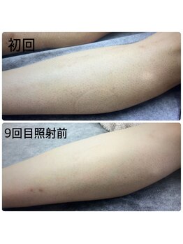 エヌアール(NR)/men's 膝下