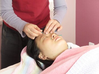 クローブ鍼灸院(CLOVE鍼灸院)