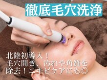 シャイニーシャイニー 金沢店(SHINY/SHINY)/ハイドラ毛穴洗浄