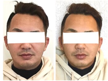 美容整体 ウェリナ 蟹江院/小顔矯正/骨盤矯正/美脚サロン