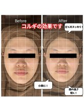 チョアチョア 札幌すすきの店(CHOA-CHOA)/コルギで顔の長さが短くなります