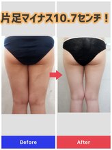 カルミア 心斎橋店/ゼロコース/30代のお客様