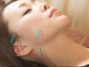 鍼灸マッサージ院りあん 片倉町/美容鍼でリフトアップ
