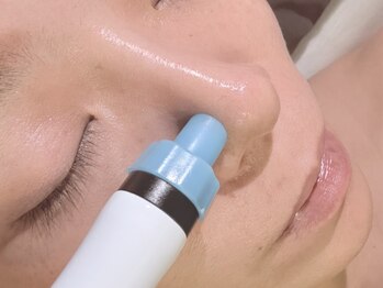 春日井エステの写真/【毛穴レススキン】一度で驚きのツルツル毛穴へ！黒ずみ・ザラつき・開き毛穴にもしっかりアプローチ☆