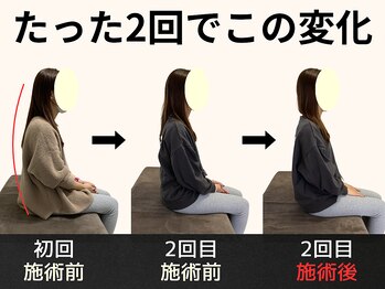 パルマ なかもず(Palma)/整体/頭痛/肩こり/ヘッドスパ