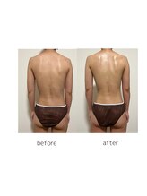 マルレ アイサロン 三軒茶屋(MARLE eyesalon)/【肩甲骨出し】and【くびれ】