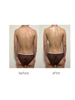 マルレ アイサロン 三軒茶屋(MARLE eyesalon)/【肩甲骨出し】and【くびれ】