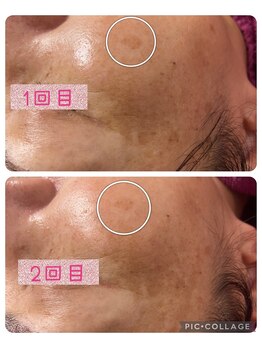 ビューティーサロン キャンディ 海老名(Candy)/