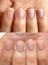 マリーロール 淀屋橋本店(Marie Laure)/自爪育成/深爪矯正/ネイルケア