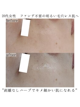 ヴェルシック(Belchic)/ノーファンデ美肌を実現