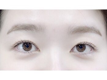 ミューズ(muse)/左右差が気になる方も