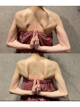 カーム 天白区野並(calm)/肩甲骨はがしビフォーアフター