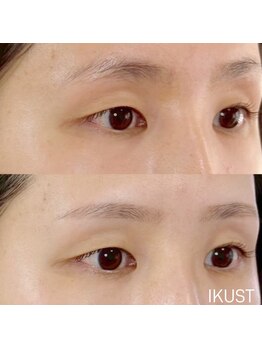 イクスト 吉祥寺(IKUST)/【眉毛/眉毛WAX/眉毛ワックス】