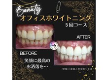 歯科衛生士在籍！しっかりサポートさせていただきます(^^♪