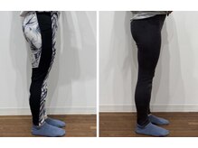 レナセール FUK 福岡店(RENACER FUK)/太ももが細くなる