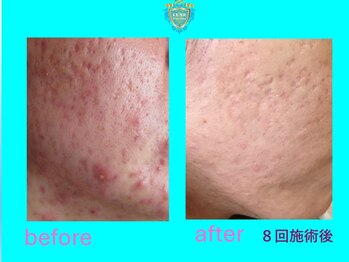 リュクス(LUXE)/ビフォーアフター