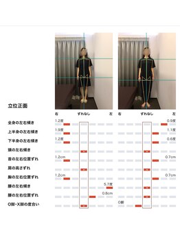 女性専用整体サロン　ベル 岩国店/ 【30代】姿勢Before After