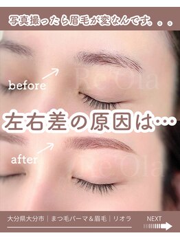 ニュートラル(neutral)/
