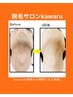 【５月限定！】最速！効果抜群◎顔脱毛全体《お得な２回》13200円→5000円