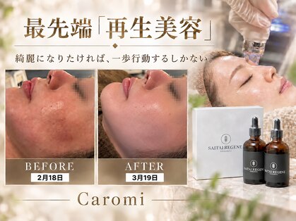 カロミ(Caromi)の写真