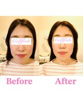 セルフィッシュ(Cellfish)/小顔×美容整体