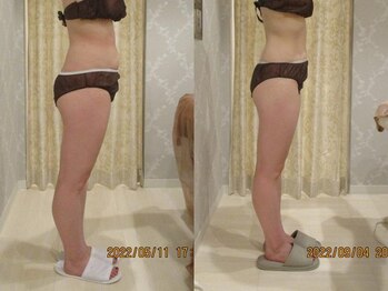 プロラボスパ 池袋東口店/20代後半　症例写真