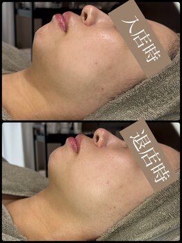 ビーエルティー(blt)/レモンボトル