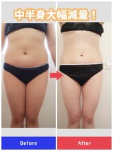 カルミア 心斎橋店/ゼロコース/30代のお客様