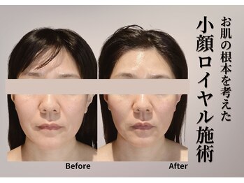 ベラ 東京院(Bella)/お顔の構造を考えた、重ねる施術