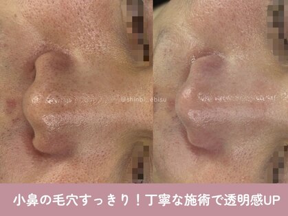 芯美 恵比寿店(shinbi)の写真