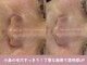 芯美 恵比寿店(shinbi)の写真
