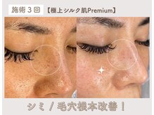 ビオエル(Bioell)の雰囲気（シミも毛穴も根本から改善◎美肌作りならお任せください♪♪）