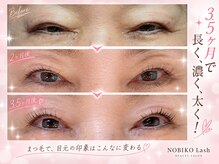 アイラッシュバーリー バイ ノブグループ(EYE LASH BARLEY by NOB GROUP)/伸びる自まつげ【まつげパーマ】