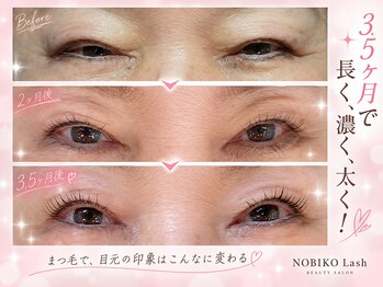 アイラッシュバーリー バイ ノブグループ(EYE LASH BARLEY by NOB GROUP)/伸びる自まつげ【まつげパーマ】