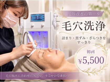 アンヘル(Angel)の写真