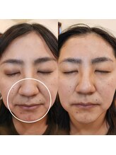 レイネイル レイエステティック 岐阜茜部店(RAY NAIL & RAY ESTHETIC)/徹底小顔！韓国肌！
