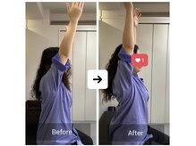 ナオル整体 三宮院(NAORU整体)/20代女性整体事例【肩凝り】