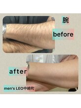 ランドマーク 中崎町(LANDMARK.)/《 腕 》