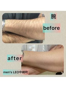 ランドマーク 中崎町(LANDMARK.)/《 腕 》